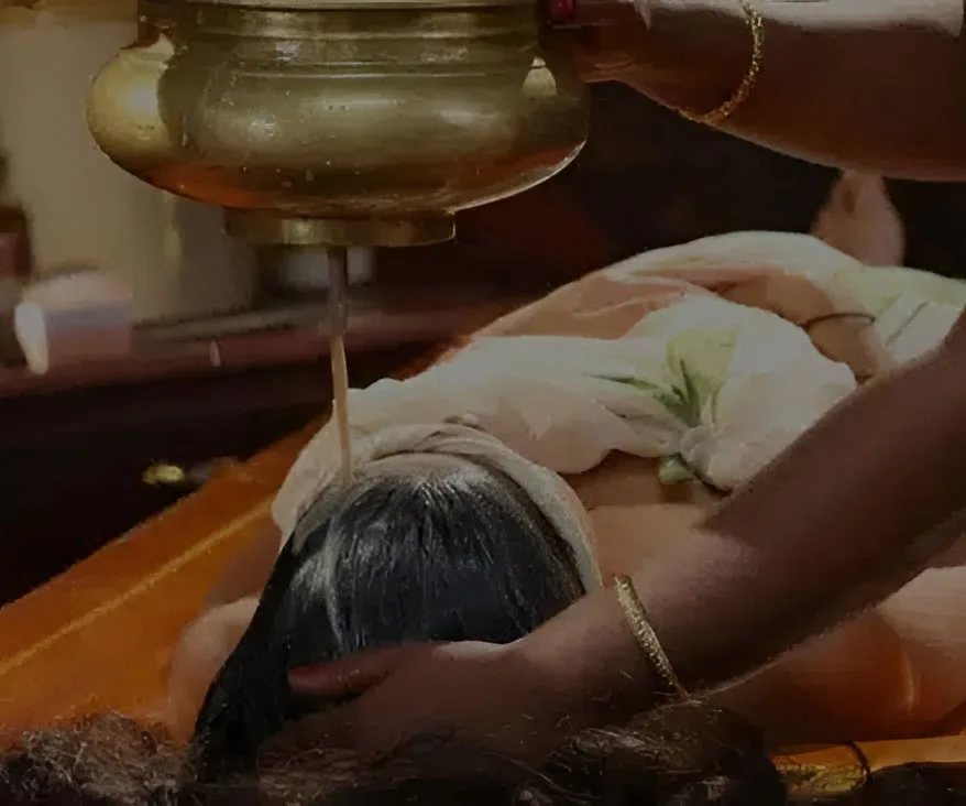 Shirodhara